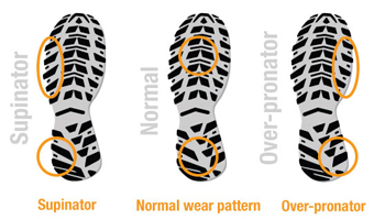 shoe-wear-pattern